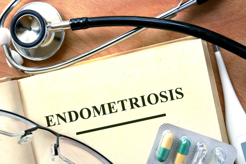 Treatments for Endometriosis
